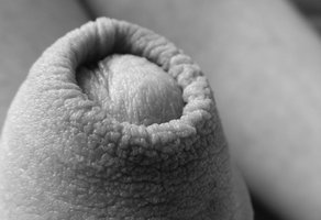 Health : Foreskin Regeneration
