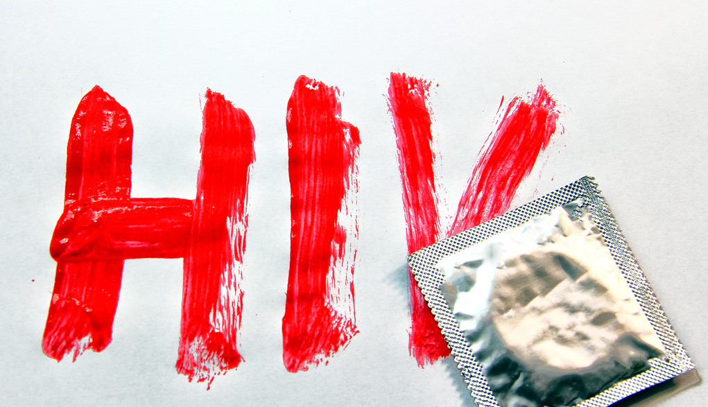 hiv
