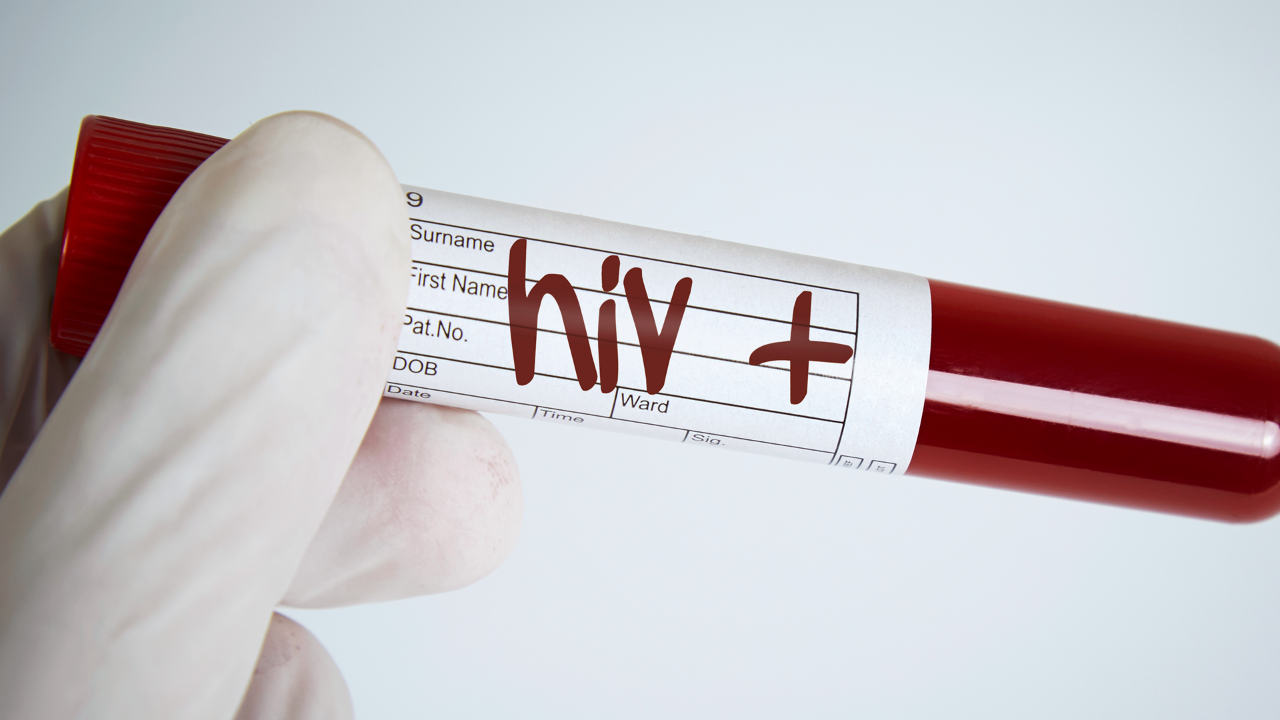 HIV : Could HIV Treatment Stop All New Cases?