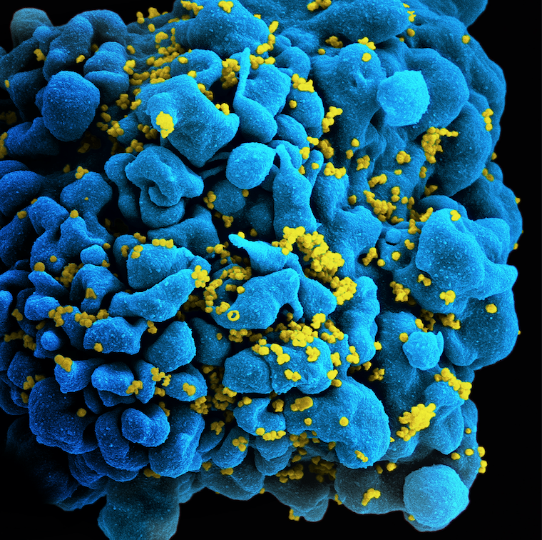 hiv