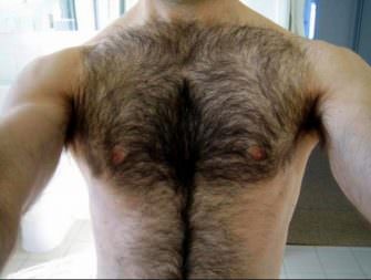Speak Out : Hairy Real Life Tale