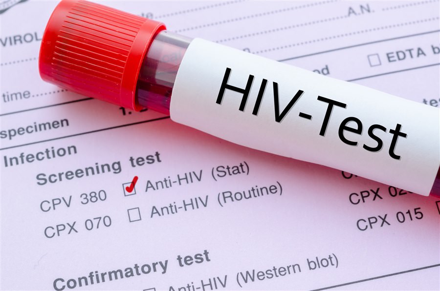 hiv
