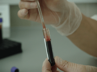 News: HIV and Syphilis Clusters Reported in Milwaukee 