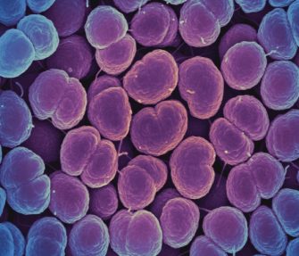 Health: STIs on the Rise among PrEP Users 