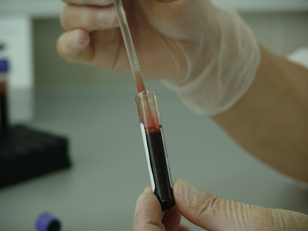 blood-20745_1920