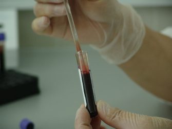 Gay Stuff: Denmark To Allow Gay Men To Donate Blood