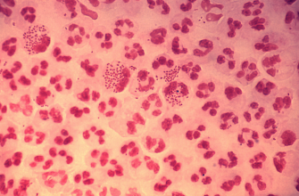 Health: US STD Rates Hit All Time High