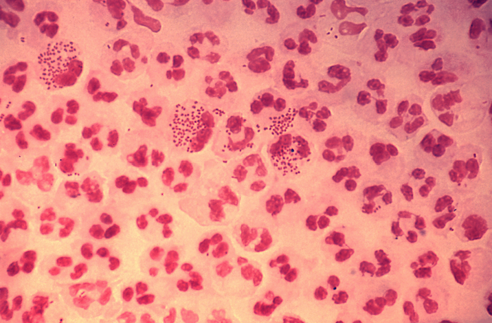std